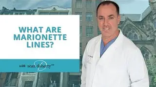 What Are Marionette Lines? Dr. Doherty Tells You How To Treat Them!