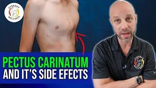 What Pectus Carinatum REALLY Means for Your Health?