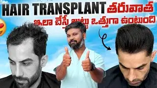 #AskDrJohnWatts | HAIR TRANSPLANT తరువాత ఇలా చేస్తే జుట్టు ఒత్తుగా ఉంటుంది |Hair Specialist Explains