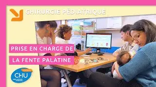 Prise en charge de la fente palatine au CHU de Montpellier
