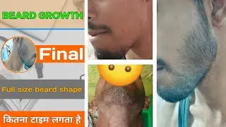 BEARD GROWTH ! Full size beard correct shape ! कितना टाइम लगता है ? How to grow beard fast 