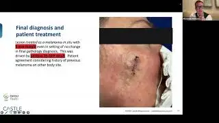 Cases with Castle: A case study webinar on ambiguous melanocytic lesions - Dr. Alexander Witkowski