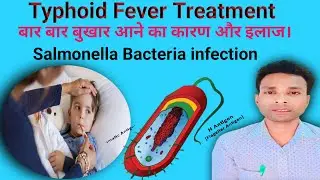 #Typhoid Fever Treatment#Typhoid Fever Cause& Symptoms#Typhid Bukhar ka ilaj in Hindi 