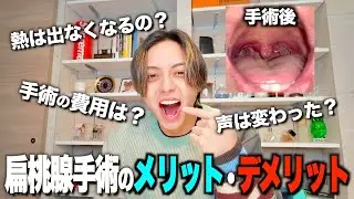 【熱はでるの？】扁桃腺を取って一年経ったのでメリット、デメリットをズバズバ言います！！【扁桃腺除去手術】