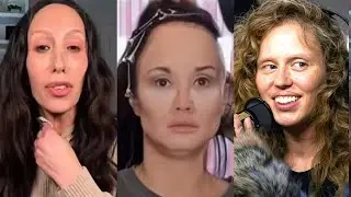 More Celebs That Don't LOOK HUMAN ANYMORE... And It's Getting Scary
