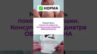 КАКОЙ СТУЛ НОРМА ИЛИ НЕТ‼️БОЛЬШЕ ИНФОРМАЦИИ В ШАПКЕ КАНАЛА‼️