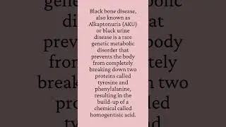 Black Bone Disease #shorts