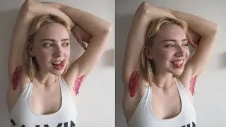 Dyeing my armpit hair pink