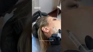 Полимолочная кислота. Запись на все обучающие программы ➡️ inst:dr.antonina_guz