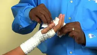 Ulna Gutter or Boxer's Cast AquaCast Application - Astir