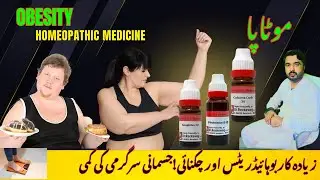 Obesity Causes Symptoms & Treatment $obesity @homeoTec best Obesity Treatment Myths Facts