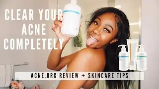 HOW I CLEARED MY ACNE + NIGHTIME ROUTINE | ACNE.ORG REVIEW
