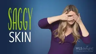 WLS Vlog: Dealing with Saggy Skin