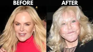 Celebrities Who Regret Going Under the Knife