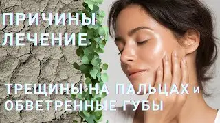Трещины на пальцах. Обветренные губы. Причины. Лечение. Что делать? Сухая кожа #сухаякожа