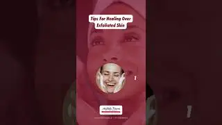 Tips For Healing Over Exfoliated Skin | Aesthetic Visions - Secunderabad