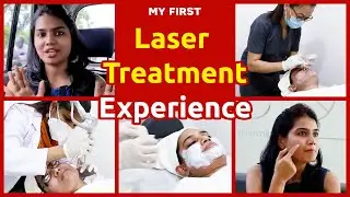 Laser Treatments in Face For Acne Scars - My Laser Resurfacing Experience