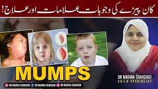 What is Mumps|signs and symptoms|dr.nagina shahzadi|child specailist