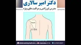 نحوه گرفتن نوار قلب از سمت راست و پشت قلب در بیماران ACS