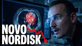 Was ist mit Novo Nordisk los? (Aktien-Check)