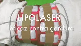 Lipolaser &eacute; top