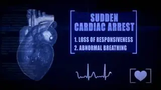 What to Do in a Cardiac Emergency