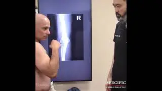 ELBOW PAIN while HAMMER CURLS   elbow