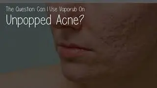 Can I Use Vaporub On Unpopped Acne?
