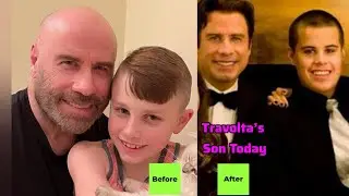 John Travolta&rsquo;s Youngest Son Ben Travolta: A Powerful Transformation That Stunned Fans | StarXpose