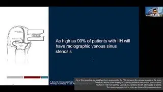 Up to 90% of IIH patients will have radiographic venous sinus stenosis. - Visish Srinivasan, MD