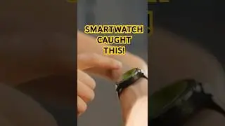 Your Watch Might Catch AFib Before You Do!  #facts #health #youtubeshorts