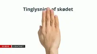 F&aring; &aelig;gtef&aelig;lle med p&aring; sk&oslash;det