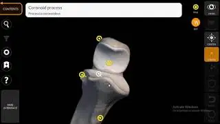 Radius, Ulna & Hand Bones شرح | Part 5 from (Upper Limb course)