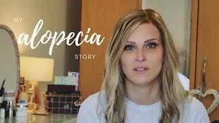 My Alopecia Story - Losing My Hair For 22 Years