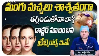 How to Remove Dark Spots & Melasma on Face | Best Dermatologist Treatments | CelesteeSkin&HairClinic