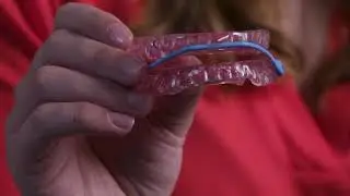 SomnoDent&reg; Avant&trade;: Our Most Comfortable Oral Appliance EVER!
