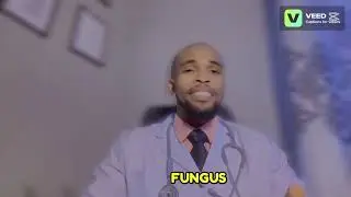 Jinsi Ya Kutibu Fangasi Sugu/ Njia Ya Asili
