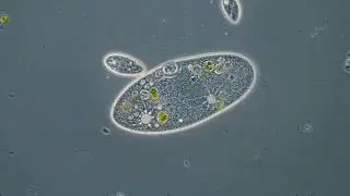 Pantoffeltierchen mit kontraktilen Vakuolen
