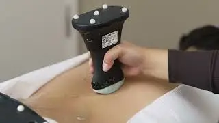 Real-Time 3D Spine Imaging with AI Ultrasound | SpineUs&trade;