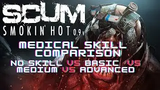 SCUM - Medical, No Skill vs Basic vs Medium vs Advanced