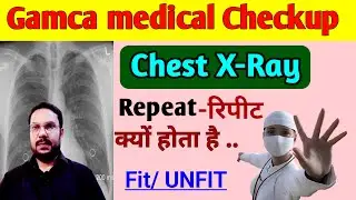 Gamca medical chest x ray Repeat क्यों होता है