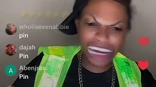 Patrick Prank Call 📱STUMPY For A Box Of Chicken Back🤣🫡