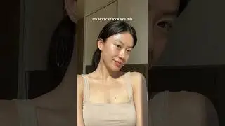 there is no such thing as a perfect skin