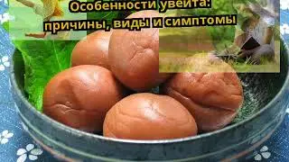Особенности увеита: причины, виды и симптомы