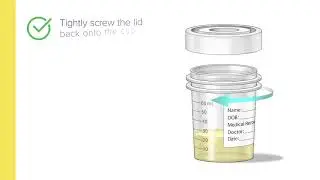 Aptima&reg; Urine Collection Kit &ndash; First Catch Patient Collected