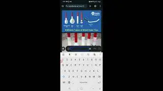 Alternative chat bot to chat GPT for blind users