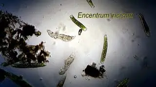 ENCENTRUM INCISUM