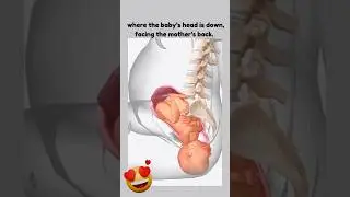 The Ideal Baby Position 😍 Occiput Anterior Position