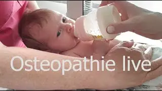 Saug- und Trinkschwäche bei Babys. Atlas Behandlung. KISS-Syndrom. Osteopathie live.