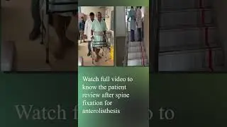 Patient review after spine fixation for anterolisthesis #ytshorts #youtubeshorts